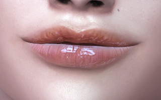Lips 178